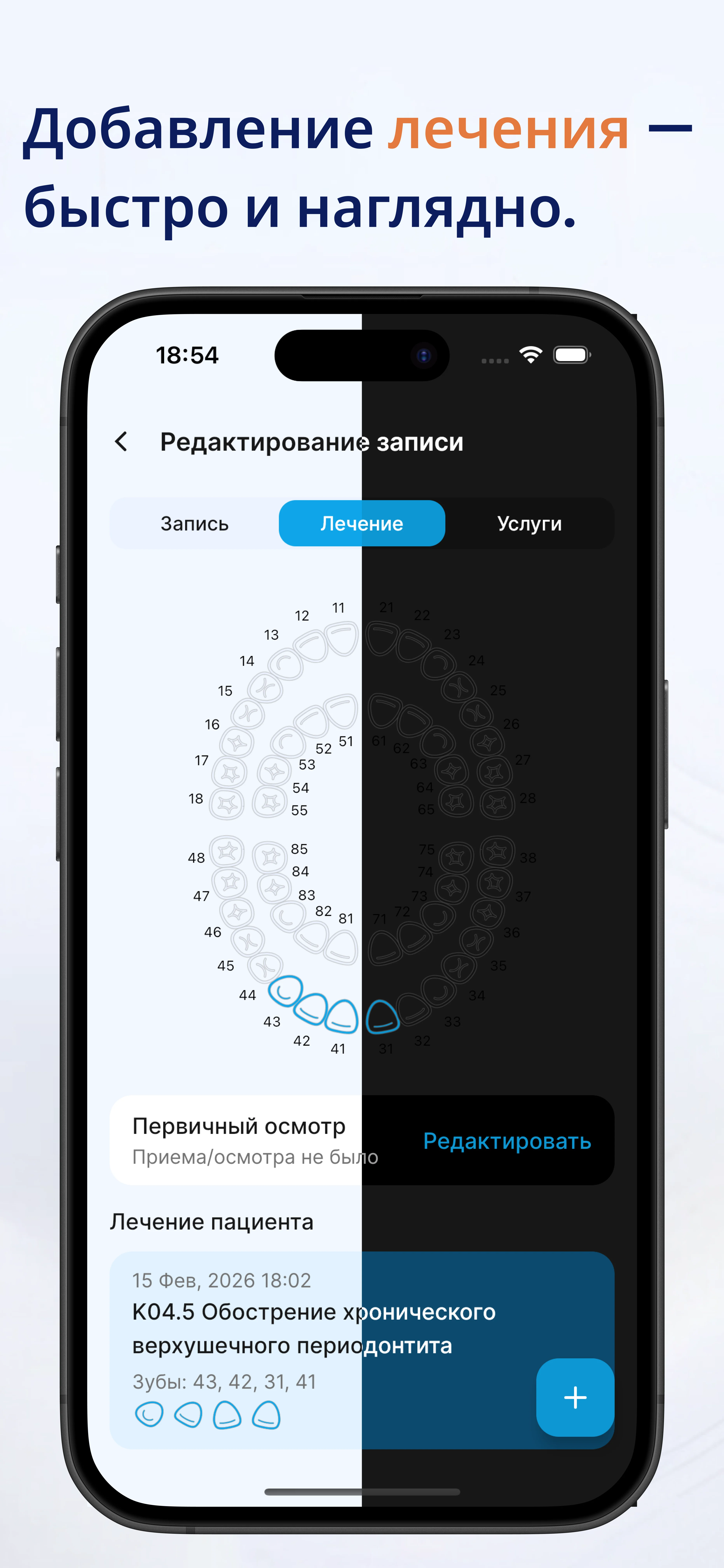 Зубная формула и лечение — Dentra